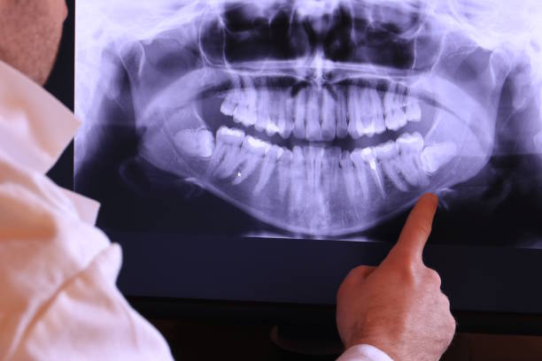 Best After-Hours Emergency Dentist in Elon, NC